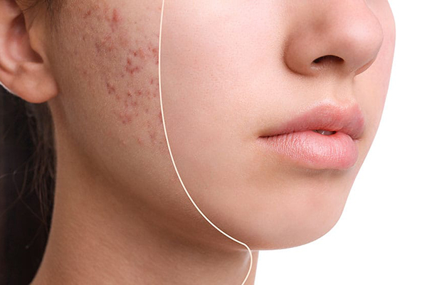 راهکارهای اختصاصی